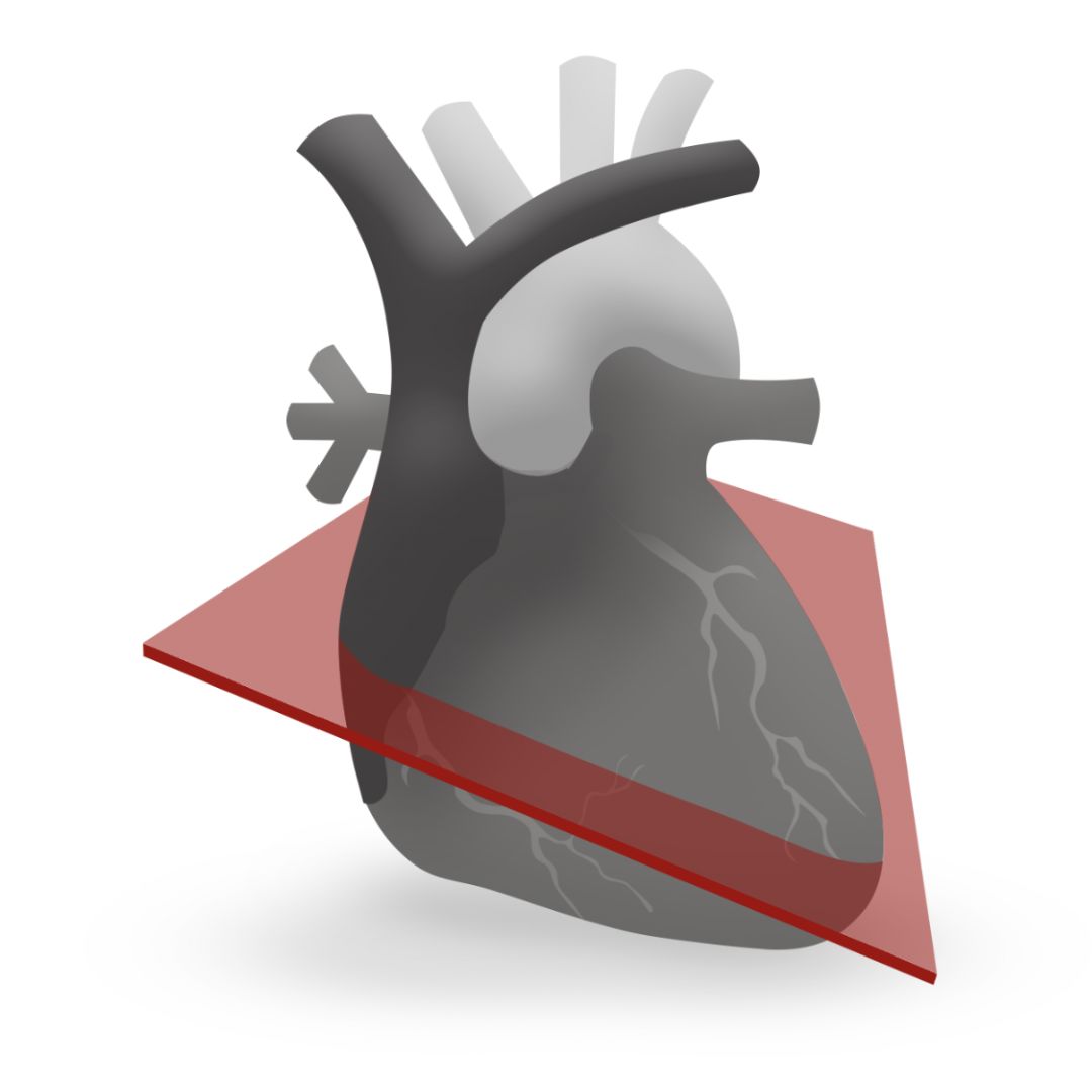 CardioServ's tweet photo. Our Mitral Valve medical illustrations won Silver for digital medical illustrations at the inaugural DANDA Awards. Huge thanks to our designer Ingrid Marais. Check out our award-winning work! 🌟 #CardioServ #DANDAAwards #MedicalIllustrations #cardiology https://t.co/kxafM0SWwW