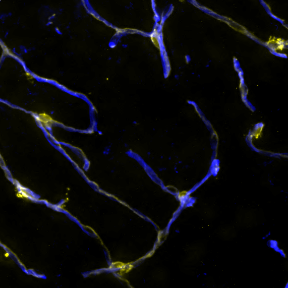 Jake_Cashion_'s tweet image. Pericytes (CD13🟡) enwrap capillaries (lectin🔵), providing essential support for neurovascular function 🧠🩸 #FluorescenceFriday