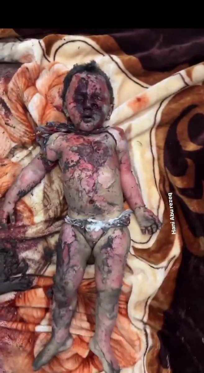 لا اعتذر لقساوة المشهد وهذا ما تفعله أسلحة امريكا بالأطفال