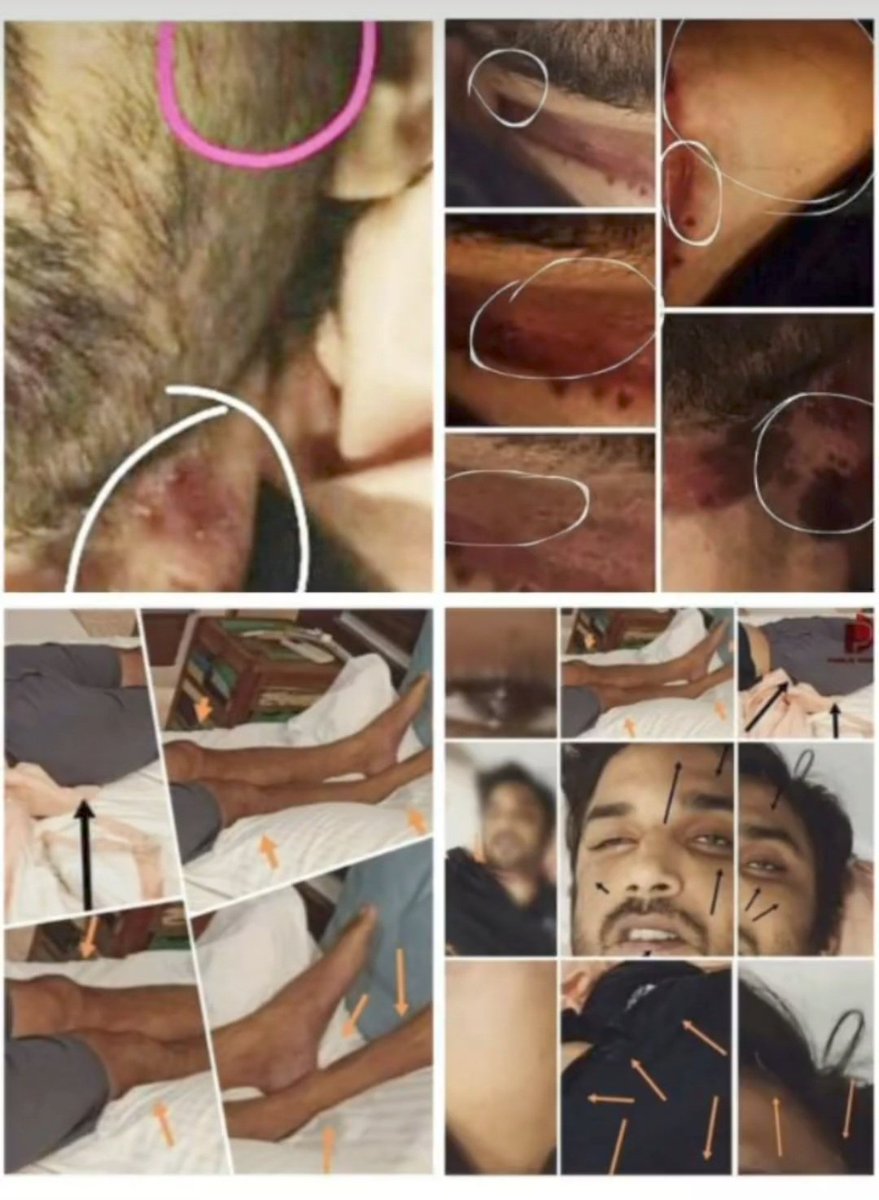 Yasmin2186's tweet photo. Shameless @CBIHeadquarters being silent it seems Sushant broke his own legs, punched himself on his left eyes, hit himself several times to get bruises,used a stun gun on himself &amp; finally hanged himself with a flimsy green cloth (without a stool).

4years Of Injustice To Sushant https://t.co/OCggZNjQnh