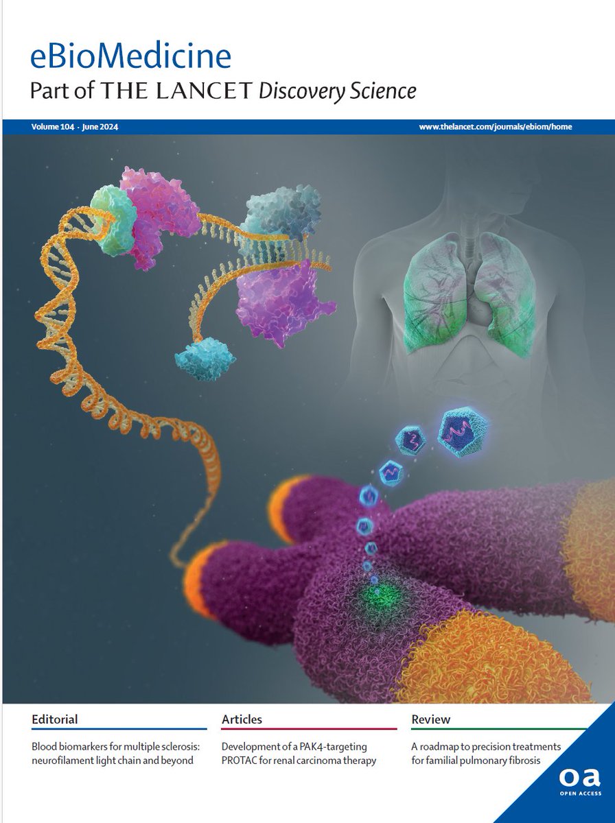 RCSI (@rcsi_irl) on Twitter photo New research led by RCSI's Professor <a href="/killian_hurley/">Killian Hurley</a> features on the front cover of the June edition of <a href="/eBioMedicine/">eBioMedicine – The Lancet Discovery Science</a>.
The paper outlines a strategic approach for developing new precision treatments for familial pulmonary fibrosis.
🔗 thelancet.com/journals/ebiom…
#RCSIdiscover New research led by RCSI's Professor <a href="/killian_hurley/">Killian Hurley</a> features on the front cover of the June edition of <a href="/eBioMedicine/">eBioMedicine – The Lancet Discovery Science</a>.
The paper outlines a strategic approach for developing new precision treatments for familial pulmonary fibrosis.
🔗 thelancet.com/journals/ebiom…
#RCSIdiscover