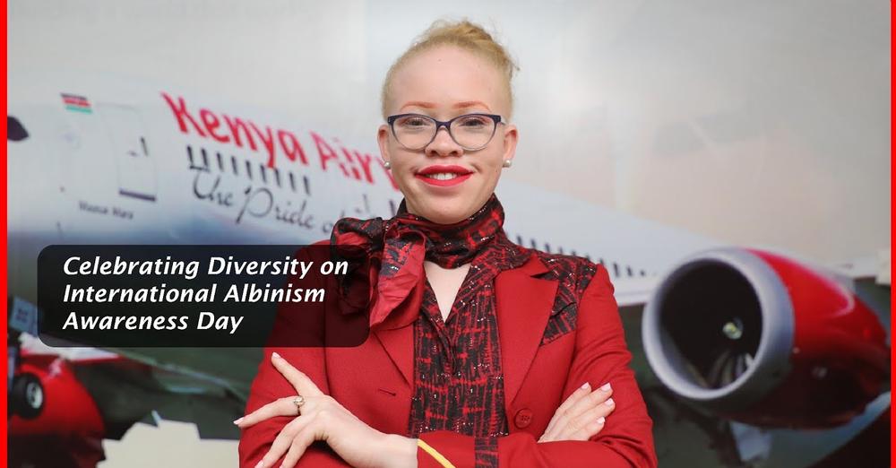 Congratulations to Loise Lihanda for becoming the first cabin crew member of Kenya Airways with albinism. 

Thank you to <a href="/KenyaAirways/">Kenya Airways</a> for marking International Albinism Awareness Day with this video.

🔗 youtu.be/x-AiL-9cyzc?fe… 
#AlbinismDay #10IAAD