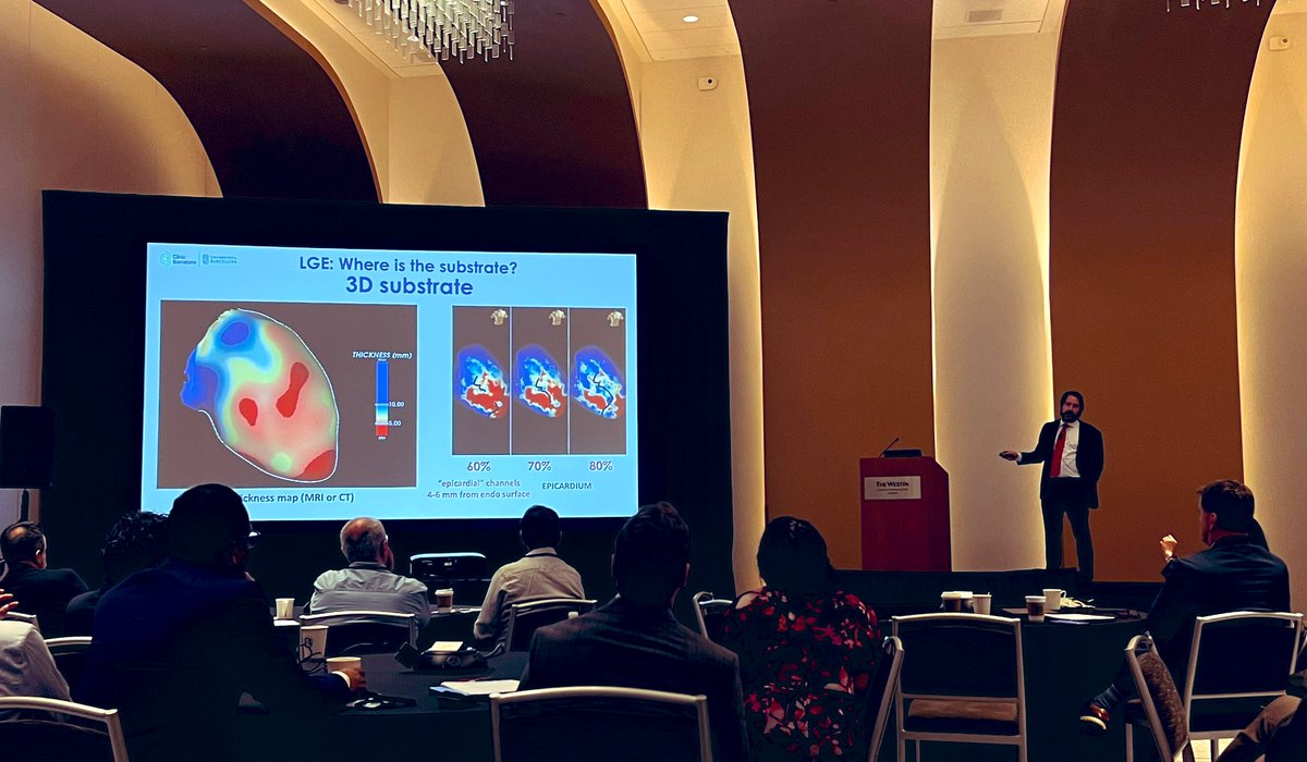 Brock Gambill (@forkknifecab_ep) on Twitter photo Brilliant work shared by <a href="/ivroca/">Ivo Roca, FEHRA, FESC</a> excited for what's next.
#EnSite S3 DeEP Mapping techniques & preprocedural imaging with <a href="/ADAS3D/">ADAS3D Medical</a>.
VT In-Depth by <a href="/JRWinterfield/">Jeffrey Winterfield</a> Dr. Wendy Tzou, et al.
<a href="/AbbottCardio/">Abbott Cardiovascular</a> Brilliant work shared by <a href="/ivroca/">Ivo Roca, FEHRA, FESC</a> excited for what's next.
#EnSite S3 DeEP Mapping techniques & preprocedural imaging with <a href="/ADAS3D/">ADAS3D Medical</a>.
VT In-Depth by <a href="/JRWinterfield/">Jeffrey Winterfield</a> Dr. Wendy Tzou, et al.
<a href="/AbbottCardio/">Abbott Cardiovascular</a>