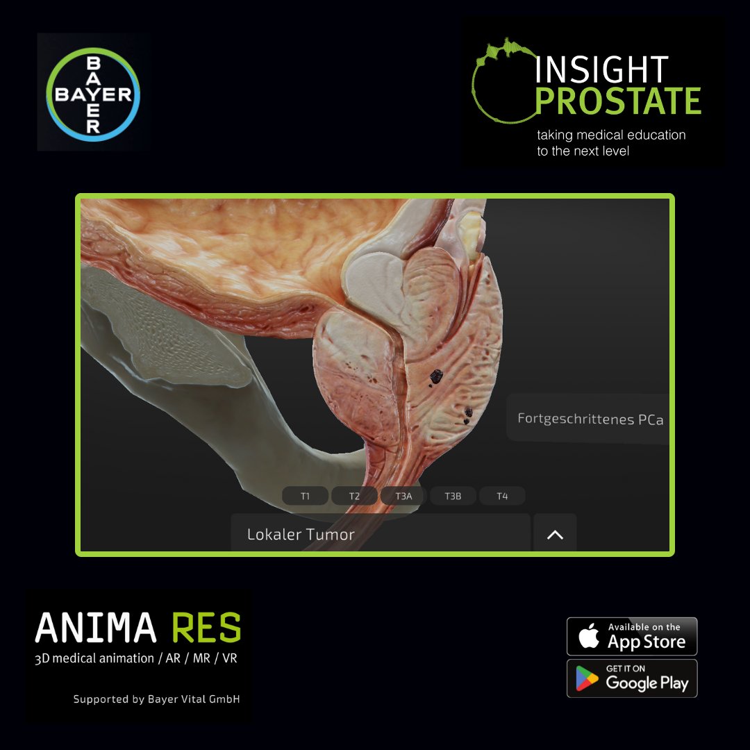 Entdecken Sie die neue #INSIGHTPROSTATE Anwendung, die im Browser genutzt werden kann und die Arzt-Patienten-Interaktion unterstützt. Tauchen Sie ein in die Welt der Prostata mit interaktiven 3D-Animationen. go.bayer.com/insightprostate #Prostatakrebs #Urologie