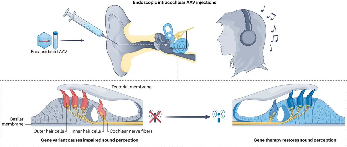 packyM's tweet image. 5 deaf kids hear with gene therapy.
Scientists discover cancer-spread gene.
FDA panel approves new Alzheimer's drug.
Bill Gates breaks ground on TerraPower nuclear plant.
IT'S TIME TO BUILD a Solugen Bioforge with $213.5M from DOE.
+How to jhana.

What a week for the optimists.