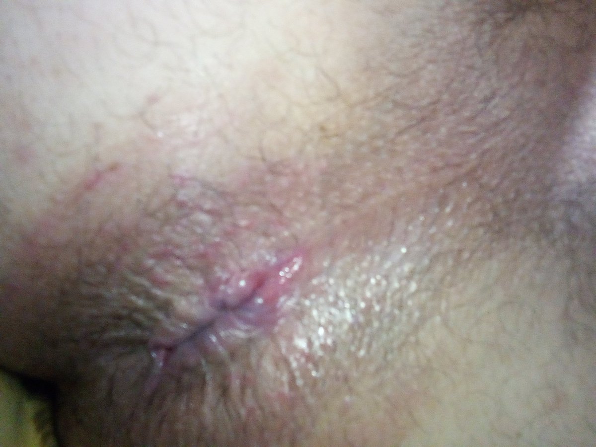 Mi anito después de tirar rico 😈😈😈onlyfans.com/posts/create