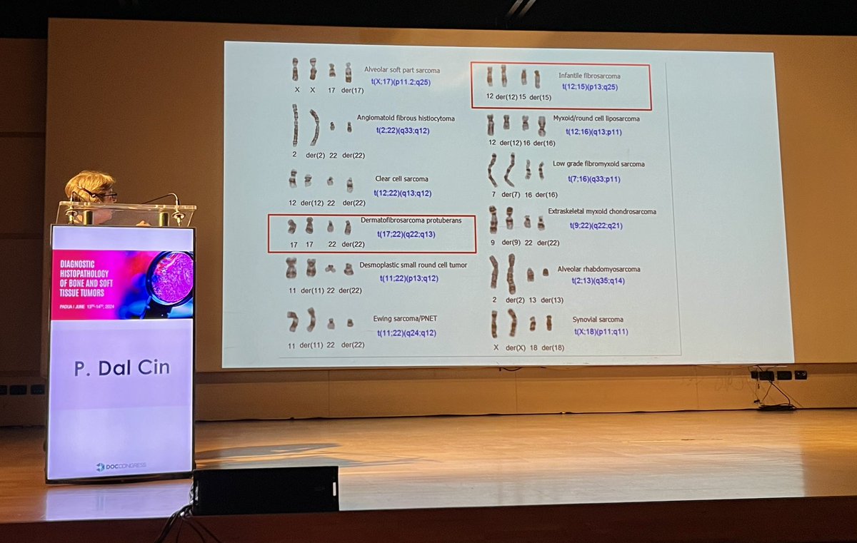 Jason L. Hornick, M.D., Ph.D. (@jlhornick) on Twitter photo Remarkable story!
A 40-year history of cytogenetics and molecular genetics in the pathogenesis and diagnosis of soft tissue tumors. Professor Paola Dal Cin.
Diagnostic Histopathology of Bone and Soft Tissue Tumors. Padua, Italy
#bstpath
#surgpath
<a href="/BWHPath/">Brigham and Women's Pathology</a> Remarkable story!
A 40-year history of cytogenetics and molecular genetics in the pathogenesis and diagnosis of soft tissue tumors. Professor Paola Dal Cin.
Diagnostic Histopathology of Bone and Soft Tissue Tumors. Padua, Italy
#bstpath
#surgpath
<a href="/BWHPath/">Brigham and Women's Pathology</a>