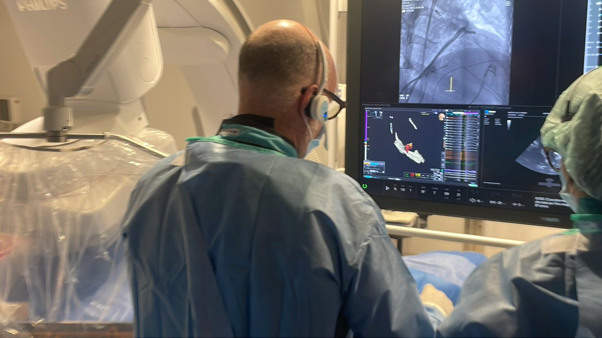 Amazing SUMMIT VT ablation : “transmural with 0,0 alcohol” by Prof <a href="/DrFerminGarcia/">Fermin Carlos Garcia</a> . Thank you <a href="/NRivasGandara/">Nuria</a> team!!!