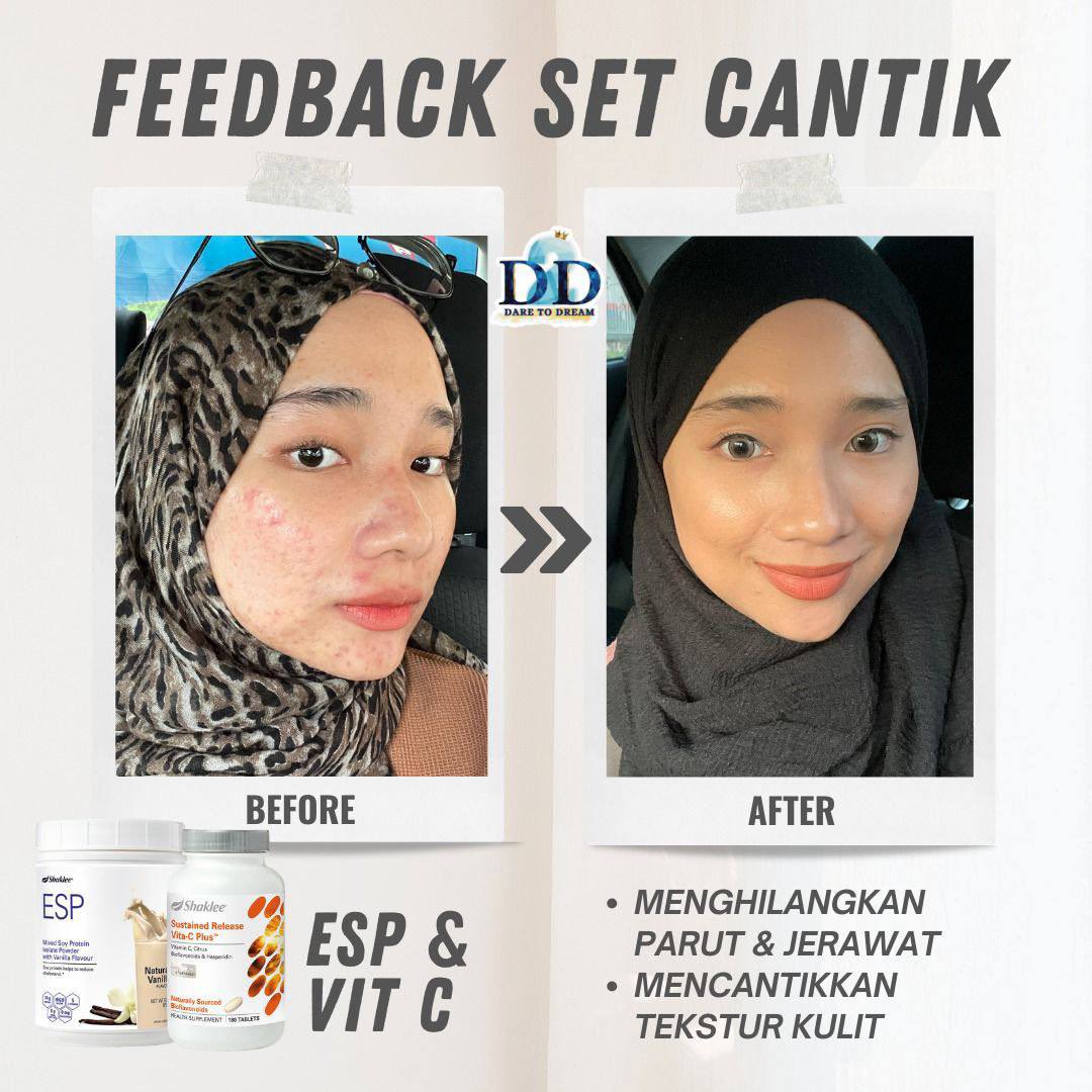 DUA NI LA ORANG SELALU CARI 😍

Pudarkan parut✅
Jerawat takde✅
Skin makin elok✅

Wahhh makin cantik la dia!! 

wasap.my/60145314641/Pr…

<a href="/RTNiaga/">RTNiaga Anda</a> <a href="/JualBeliKuantan/">JualBeliKuantan</a> <a href="/KuantanInfo/">🇲🇾info.kuantan🇲🇾</a> <a href="/KuantanOnline/">Kuantan Online</a> <a href="/KuantanTV/">Kuantan Pahang</a>