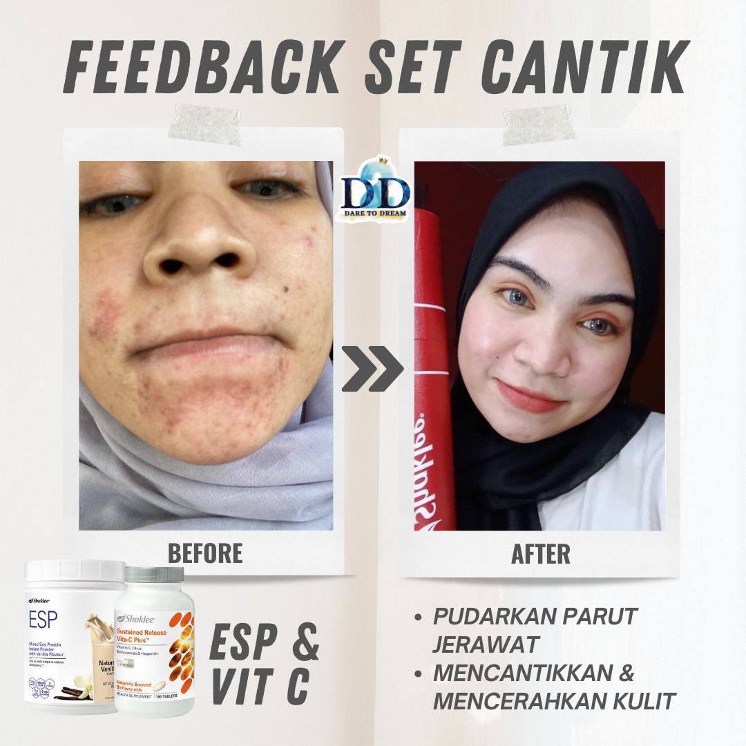SEKARANG TENGAH ADA PROMO ‼️

Buy 2 free 1 😱

Memang jimat sangat la! 

✅elok untuk skin
✅beri tenaga
✅sesuai untuk ibu hamil/menyusu/pantang
✅milkbooster 

wasap.my/60145314641/Pr…

<a href="/RTNiaga/">RTNiaga Anda</a> <a href="/JualBeliKuantan/">JualBeliKuantan</a> <a href="/KuantanInfo/">🇲🇾info.kuantan🇲🇾</a> <a href="/KuantanOnline/">Kuantan Online</a> <a href="/KuantanTV/">Kuantan Pahang</a>