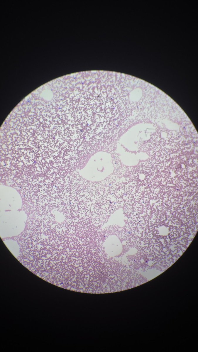 Path_Mags's tweet image. Happy Friday everyone 😄 #pathology #hemepath