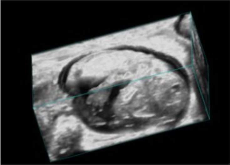 La plateforme IPAM de @biocampus recrute un.e ingénieur.e en biologie animale pour un CDD de 16 mois à compter du 1er septembre 2024.  Renseignements et candidatures (avant le 5 juillet) sur @emploiCNRS :  emploi.cnrs.fr/Offres/CDD/UAR…