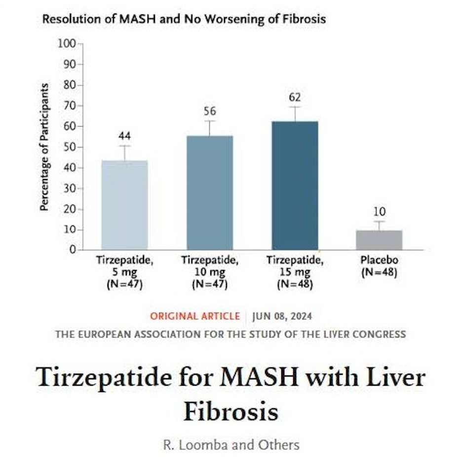 Saul Karpen (@saulkarpen) on Twitter photo Impactful week for the Stravitz-Sanyal Institute for Metabolic Health and Liver Disease <a href="/VCU_Liver/">VCU Stravitz-Sanyal Institute for Liver Disease</a> : Major MASH clinical trial presentations at EASL by Dr. Arun Sanyal (with 2 <a href="/NEJM/">NEJM</a> publications). Important for hepatology and mostly for our patients.@arunjsanyalvcu,<a href="/DrLoomba/">Rohit Loomba</a> Impactful week for the Stravitz-Sanyal Institute for Metabolic Health and Liver Disease <a href="/VCU_Liver/">VCU Stravitz-Sanyal Institute for Liver Disease</a> : Major MASH clinical trial presentations at EASL by Dr. Arun Sanyal (with 2 <a href="/NEJM/">NEJM</a> publications). Important for hepatology and mostly for our patients.@arunjsanyalvcu,<a href="/DrLoomba/">Rohit Loomba</a>