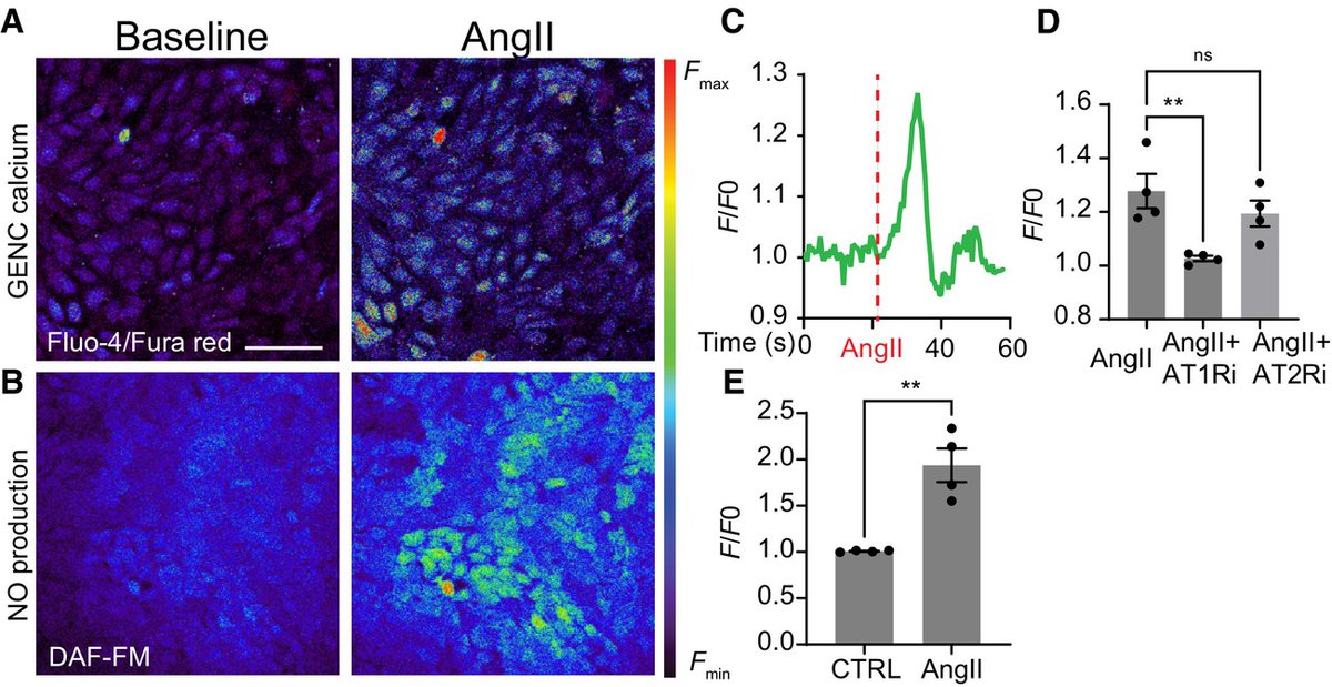 JAHA (@jaha_aha) on Twitter photo New study of the mouse brain and kidney by <a href="/AlejandraBecCal/">Alejandra Becerra Calderon</a> <a href="/gyarmatigina/">Georgina Gyarmati</a> et al shows the direct effects of #angiotensin II on endothelial cells and its role in #hypertension associated endothelial dysfunction. #AHAJournals <a href="/KECKSchool_USC/">Keck School of Medicine of USC</a> <a href="/USC_ZilkhaNeuro/">USC Zilkha Neuro Institute & PHNS Department</a> ahajrnls.org/4ek7B6X New study of the mouse brain and kidney by <a href="/AlejandraBecCal/">Alejandra Becerra Calderon</a> <a href="/gyarmatigina/">Georgina Gyarmati</a> et al shows the direct effects of #angiotensin II on endothelial cells and its role in #hypertension associated endothelial dysfunction. #AHAJournals <a href="/KECKSchool_USC/">Keck School of Medicine of USC</a> <a href="/USC_ZilkhaNeuro/">USC Zilkha Neuro Institute & PHNS Department</a> ahajrnls.org/4ek7B6X