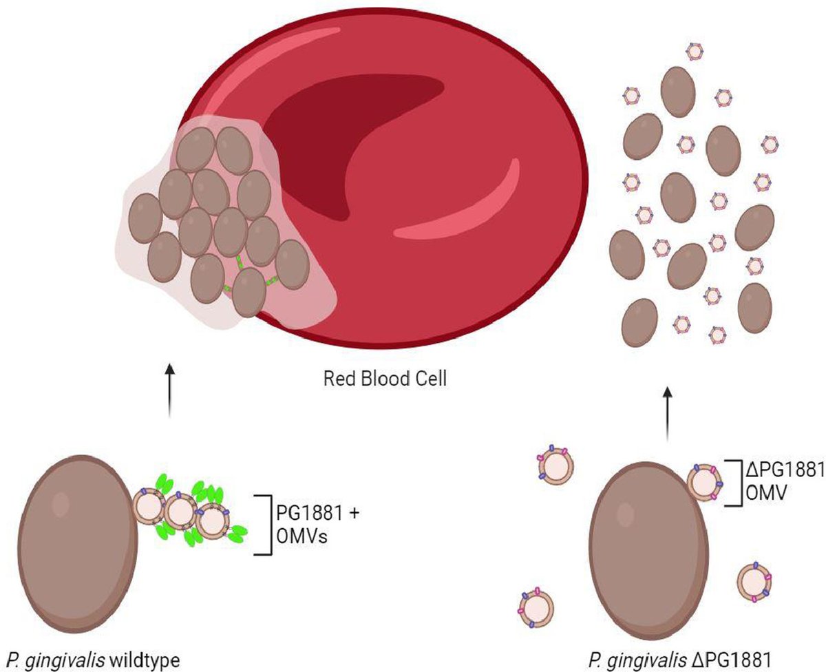 Manda Yu (@yumanda31) on Twitter photo I am glad that this is out! The work has established a new aspect of the interaction between Porphyromonas gingivalis and red blood cells
<a href="/yiweichang/">Yi-Wei Chang</a> <a href="/ForsythResearch/">The ADA Forsyth Institute</a>
sciencedirect.com/science/articl… I am glad that this is out! The work has established a new aspect of the interaction between Porphyromonas gingivalis and red blood cells
<a href="/yiweichang/">Yi-Wei Chang</a> <a href="/ForsythResearch/">The ADA Forsyth Institute</a>
sciencedirect.com/science/articl…