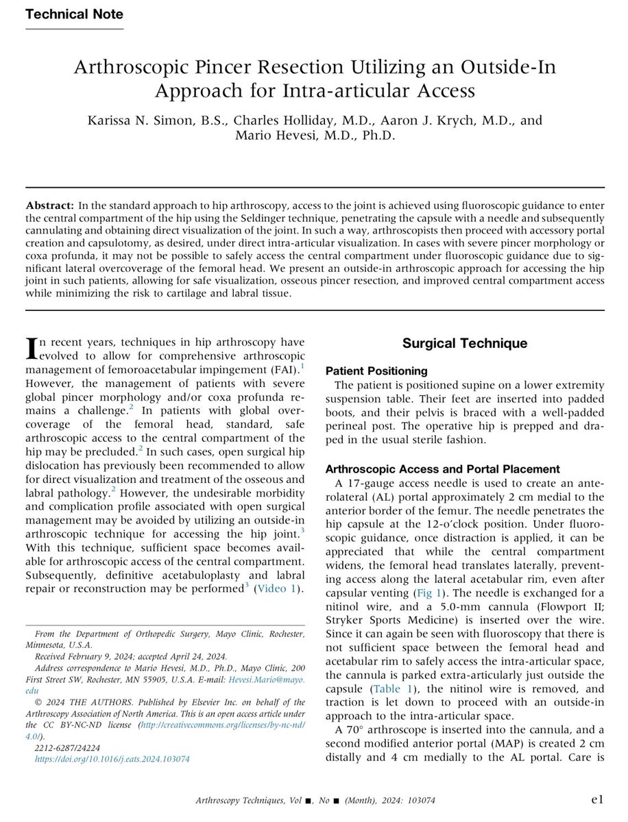 Check out our latest #HipArthroscopy tips and tricks - this time in the form of outside-in access, particularly useful for large pincers.

sciencedirect.com/science/articl…