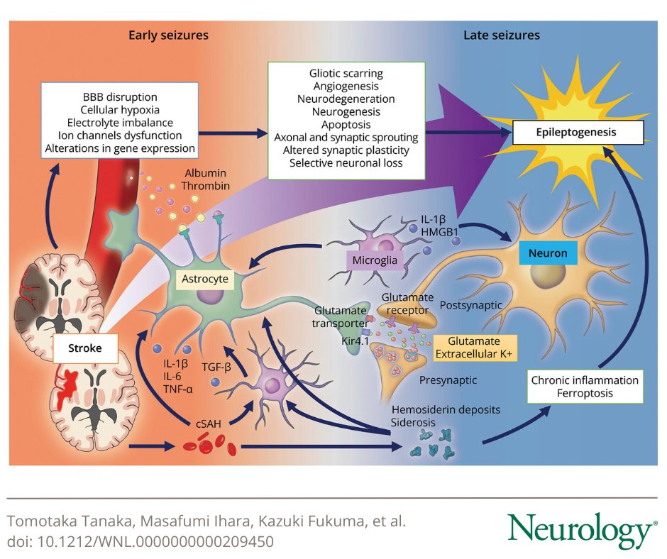 This narrative review summarizes the current understanding of poststroke epileptogenesis, risks, prognostic models, primary and secondary prophylaxis, and proposes strategies to advance the research, particularly aimed at preventing poststroke #epilepsy: bit.ly/4ci2S3W