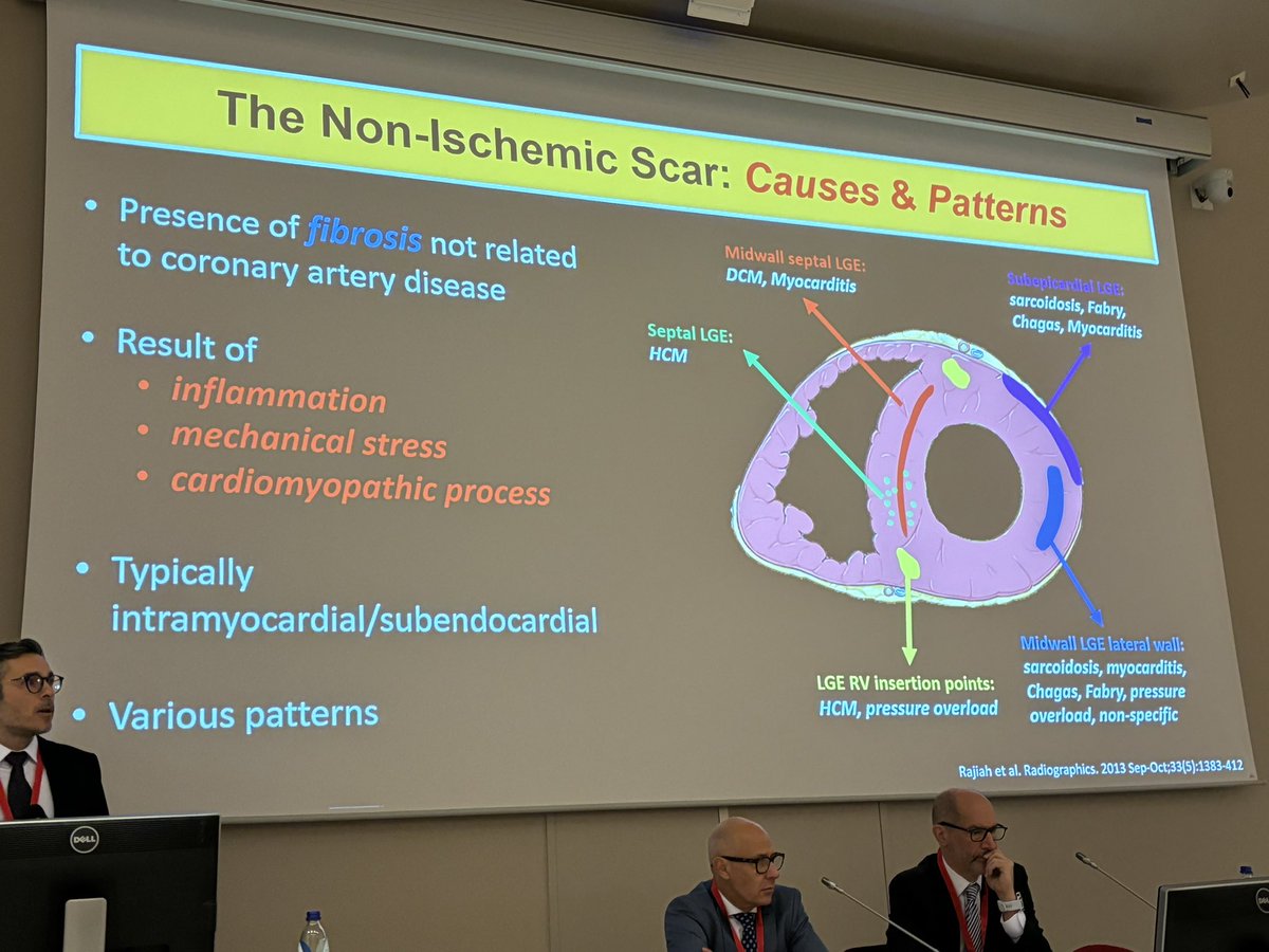 Thomas Deneke (@epdeneke) on Twitter photo Good morning from #TogetherVT2024 from Leiden. Starting off the day with discussion about diagnosis, treatment and specific cases of PVC. <a href="/KatjaZeppenfeld/">Katja Zeppenfeld</a> <a href="/PaoloDellaBell1/">Paolo Della Bella</a> <a href="/Dr_Santangeli/">Pasquale Santangeli</a> <a href="/Phiso_de/">Philipp Sommer</a> <a href="/AriSultanEP/">Arian Sultan</a> <a href="/JosefKautzner/">Josef Kautzner</a> Good morning from #TogetherVT2024 from Leiden. Starting off the day with discussion about diagnosis, treatment and specific cases of PVC. <a href="/KatjaZeppenfeld/">Katja Zeppenfeld</a> <a href="/PaoloDellaBell1/">Paolo Della Bella</a> <a href="/Dr_Santangeli/">Pasquale Santangeli</a> <a href="/Phiso_de/">Philipp Sommer</a> <a href="/AriSultanEP/">Arian Sultan</a> <a href="/JosefKautzner/">Josef Kautzner</a>