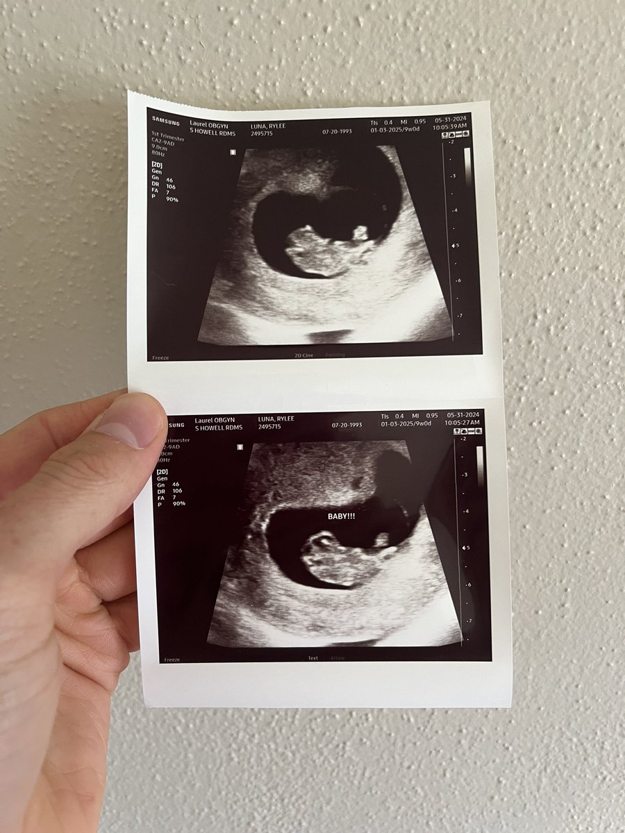 Lunatoons25's tweet photo. Hooo boy, we got a new camper on the way!
Due January ‘25 😁

👦🏼👦🏻 https://t.co/quOMndLNOb