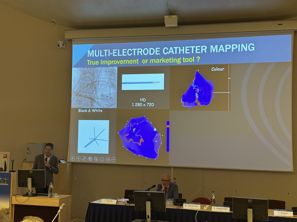 Leiden Electrophysiology (@ep_leiden) on Twitter photo There’s still more to go in Together VT 🇳🇱
Mapping, imaging, devices, anatomy, histology, signals! EP at its best 🫀<a href="/KatjaZeppenfeld/">Katja Zeppenfeld</a> @SebastiaanPiers <a href="/HWijnmaalen/">Hadrian Wijnmaalen</a> <a href="/martaderiva/">Marta de Riva</a> There’s still more to go in Together VT 🇳🇱
Mapping, imaging, devices, anatomy, histology, signals! EP at its best 🫀<a href="/KatjaZeppenfeld/">Katja Zeppenfeld</a> @SebastiaanPiers <a href="/HWijnmaalen/">Hadrian Wijnmaalen</a> <a href="/martaderiva/">Marta de Riva</a>