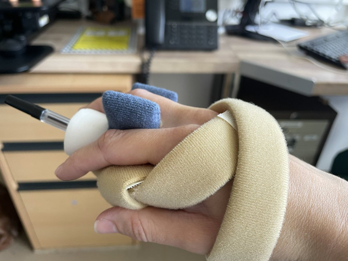 Helena Rampley (@helenarampleyot) on Twitter photo Friday afternoon foray into functional splinting to enable our pt to access his phone using a stylus. He stills needs assistance but this helped him at least maintain his grip & gain a little more agency. Thanks for your tips <a href="/sarah_dzu_OT/">Sarah Dzumbira</a>! Friday afternoon foray into functional splinting to enable our pt to access his phone using a stylus. He stills needs assistance but this helped him at least maintain his grip & gain a little more agency. Thanks for your tips <a href="/sarah_dzu_OT/">Sarah Dzumbira</a>!