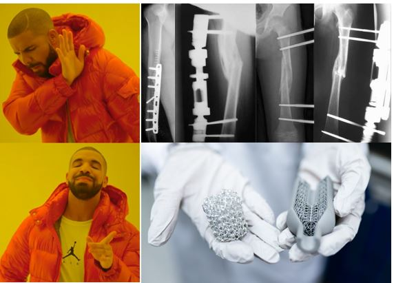Si te hablo de IMPLANTES DE HUESO, ¿piensas en escalofriantes radiografías llenas de clavos?☠️
Quédate! aquí verás implantes con geometrías ✨tan bonitas✨que enmarcarás tu radiografía, entenderás la ingeniería de materiales con gel de purpurina💅 y mucho más 
Abro #HiloTesis👇