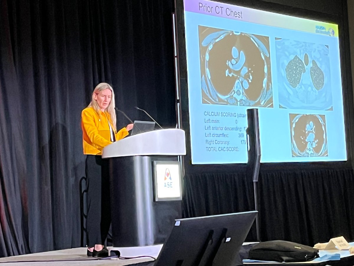Charlotte Manisty (@dr_manisty) on Twitter photo Don’t ignore general cardiac disease in #cardioonc. Fantastic presentation from <a href="/AnaBaracCardio/">Ana Barac, MD, PhD, FACC, FAHA</a> at #ASE20214 Don’t ignore general cardiac disease in #cardioonc. Fantastic presentation from <a href="/AnaBaracCardio/">Ana Barac, MD, PhD, FACC, FAHA</a> at #ASE20214