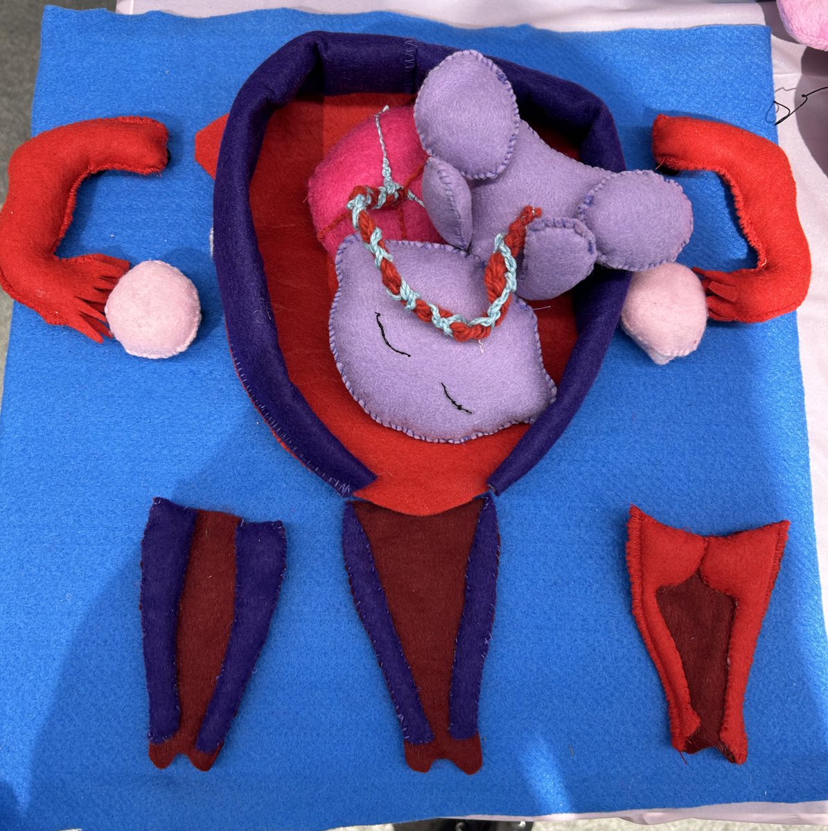 danielle thornton 💙 (@danithornton123) on Twitter photo Amazing day at the <a href="/ExRdFestival/">Great Exhibition Road Festival</a> speaking about reproductive anatomy and hormones. Stand is in the body zone and will be there tomorrow. Big thanks to <a href="/AndreaSmith1302/">Andrea Smith 💜🌈</a> for the brilliant felt models - very talented!@ImperialPeople <a href="/WHRCImp/">WHRC Imperial College, London</a> <a href="/ImperialNHS/">Imperial NHS 💙</a> <a href="/WHRCImp/">WHRC Imperial College, London</a> @WomensHealthICL Amazing day at the <a href="/ExRdFestival/">Great Exhibition Road Festival</a> speaking about reproductive anatomy and hormones. Stand is in the body zone and will be there tomorrow. Big thanks to <a href="/AndreaSmith1302/">Andrea Smith 💜🌈</a> for the brilliant felt models - very talented!@ImperialPeople <a href="/WHRCImp/">WHRC Imperial College, London</a> <a href="/ImperialNHS/">Imperial NHS 💙</a> <a href="/WHRCImp/">WHRC Imperial College, London</a> @WomensHealthICL