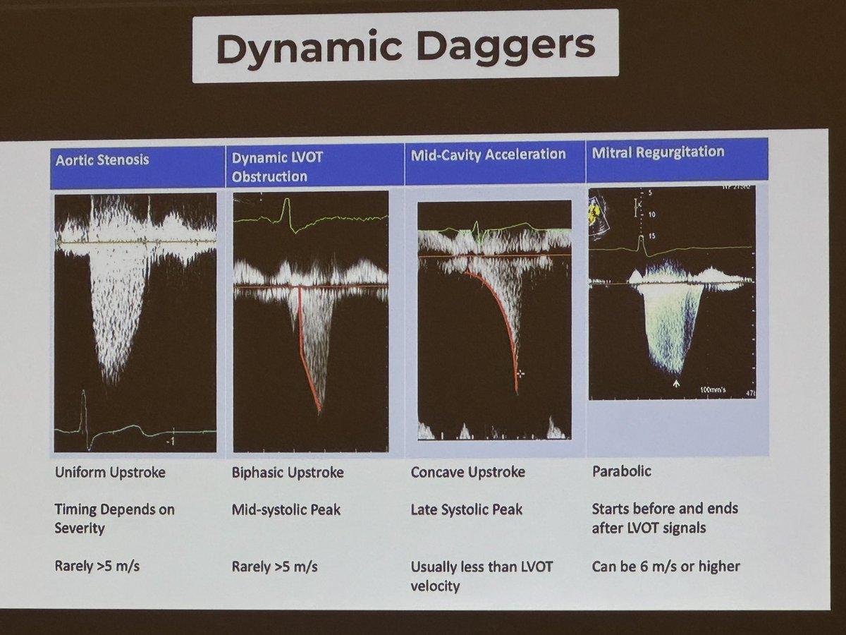 Patrycja Galazka (@patrycjagalazka) on Twitter photo Which Doppler profile best represents obstructive HCM? #Kahoot game at #ASE2024 <a href="/sarahcud/">Sarah Cuddy</a> @MattPetersMD <a href="/renujain19/">Renu</a> <a href="/ASE360/">American Society of Echocardiography</a> Which Doppler profile best represents obstructive HCM? #Kahoot game at #ASE2024 <a href="/sarahcud/">Sarah Cuddy</a> @MattPetersMD <a href="/renujain19/">Renu</a> <a href="/ASE360/">American Society of Echocardiography</a>