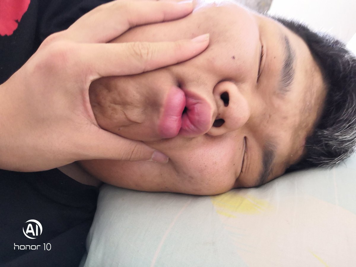 guhun030's tweet photo. 🐷🐷困了 怎么办 https://t.co/fWEbYntBNj