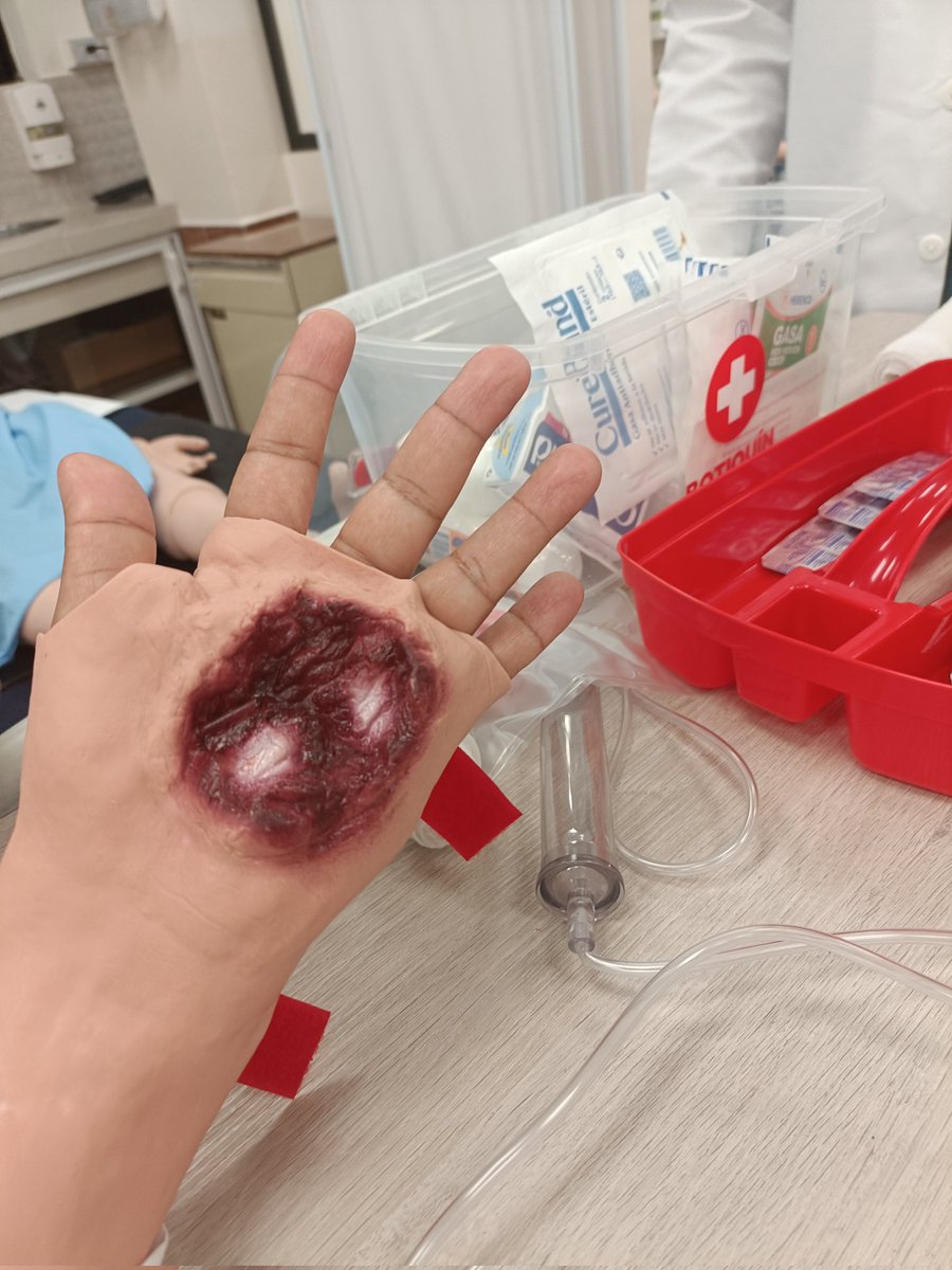 anlu_lu's tweet photo. ¡ATENCIÓN! 🩹🩺
En caso de una #Herida o #Hemorragia es de crucial importancia actuar con rapidez para #Prevenir complicaciones y así tener una pronta recuperación 
@joesystemas #Salud 👩🏻‍⚕️.+ https://t.co/7KjZ5Haznl