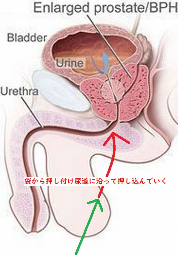 prostate727's tweet photo. 会陰

アネロスなど器具はアナルから会陰までの長さが決まっている

私の会陰は日によってベストな位置が違う

そこで色んな棒で会陰を刺激

ポイントはそのまま会陰に当てるのではなく陰嚢側から落とすように押し込む

袋から刺激すると袋下から恥骨や下腹部に刺激が行きやすい
＃ドライオーガズム https://t.co/aGxOxhbCMf