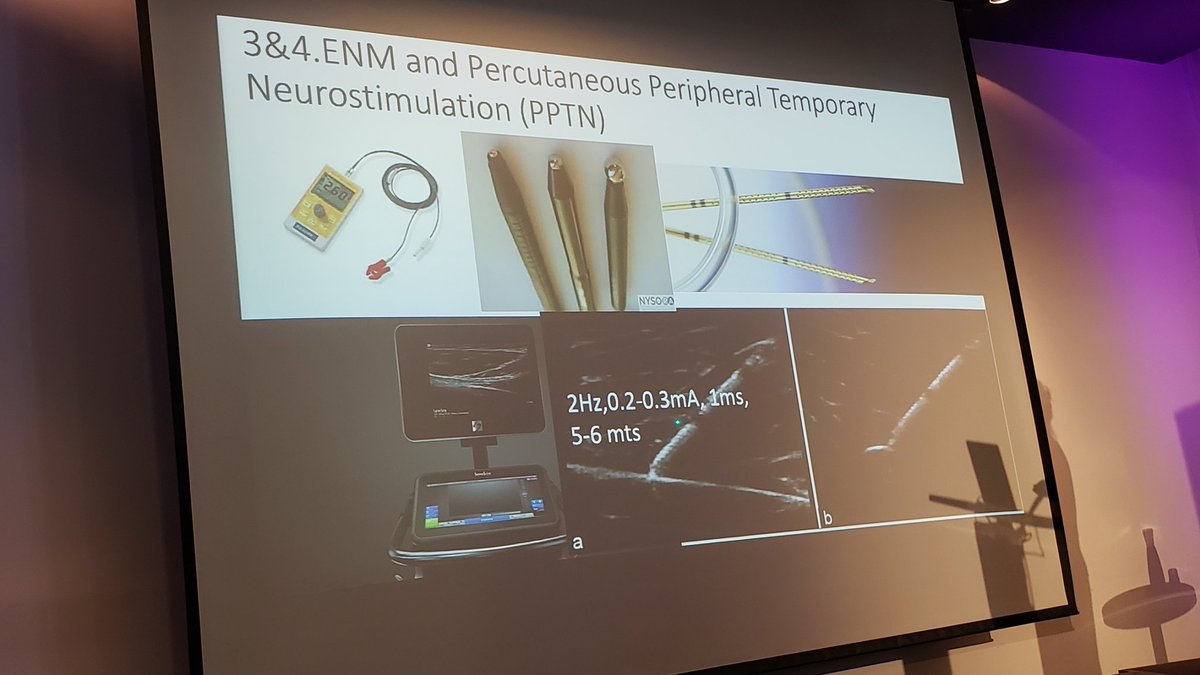 EMARIANOMD's tweet photo. Excellent discussion of chronic postsurgical pain and potential role of neuromodulation and neurostimulation by @athmathottungal #NYSORASummit 

Thoughtful progressive algorithm 👇🏽 and very interesting concept of "percutaneous peripheral temporary neurostimulation" https://t.co/IzsAAutMjY