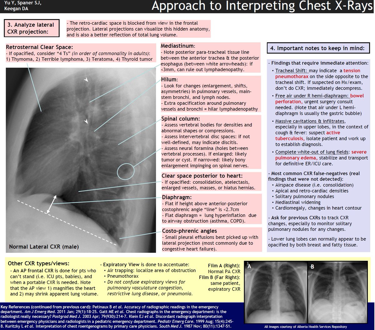 ManualOMedicine's tweet photo. @imedverse @DocScribbles Chest X-Ray Interpretation https://t.co/Gx7Z7Xuk4R