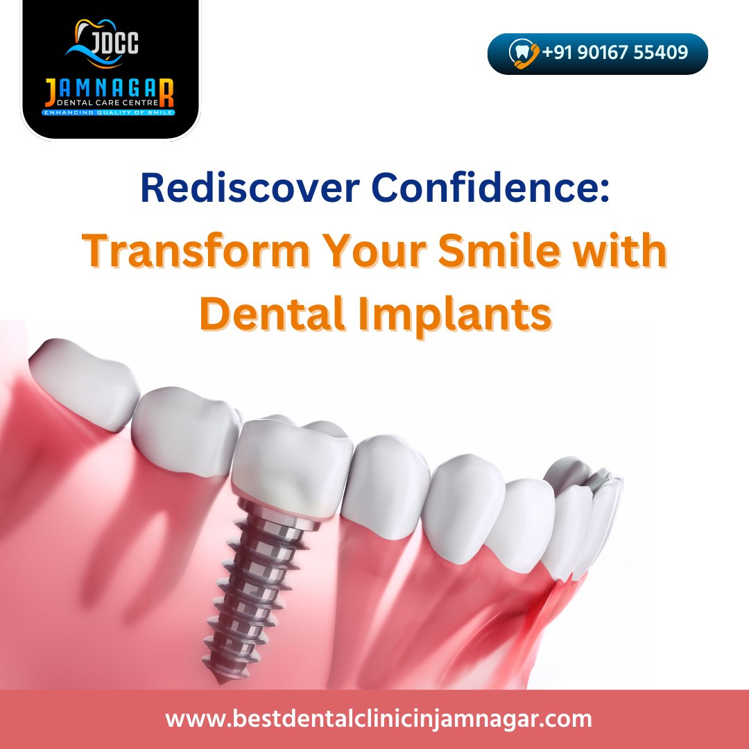 Rediscover Confidence: Transform Your Smile with Dental Implants -<a href="/JDCCjamnagar/">Jamnagar dental care center</a> Best Dental Clinic in Jamnagar

📞 +91 90167 55409
📍 જય માતાજી હોટેલની સામે, જોલી બંગલા પાસે, એસ ટી રોડ, જામનગર - ૩૬૧૦૦૫

#bestdentistinjamnagar #jamnagardentalcarecenter #jdcc