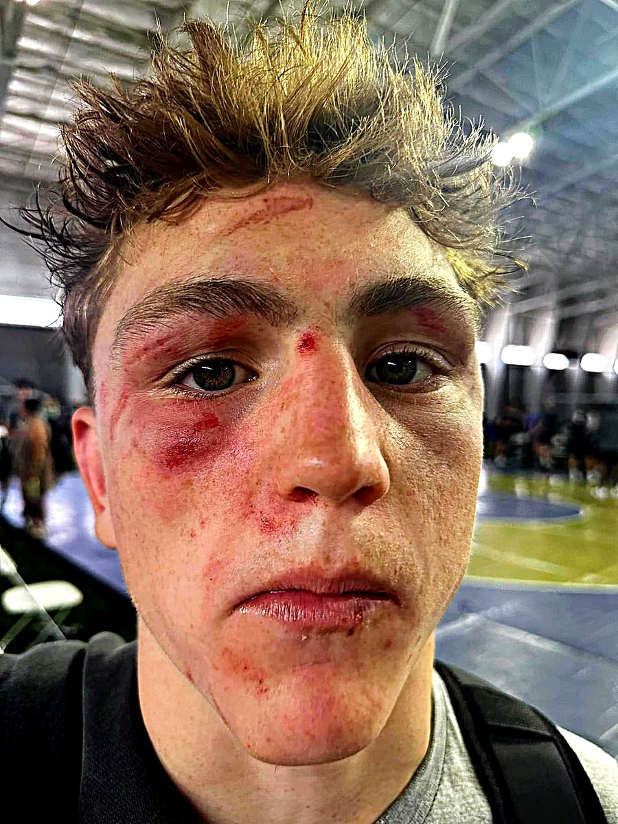 This is the face of 18 battles in 4 days. #TAH <a href="/StaleyWrestling/">Staley Wrestling</a> <a href="/NKCSchools/">NKC Schools</a> <a href="/missouriwrestle/">Missouri Wrestling</a> <a href="/millersipes20/">Miller</a> <a href="/DrNKCtech/">Eric Sipes</a> <a href="/sipesfran/">Francie Sipes</a> <a href="/sipesason24/">Mason Sipes</a>