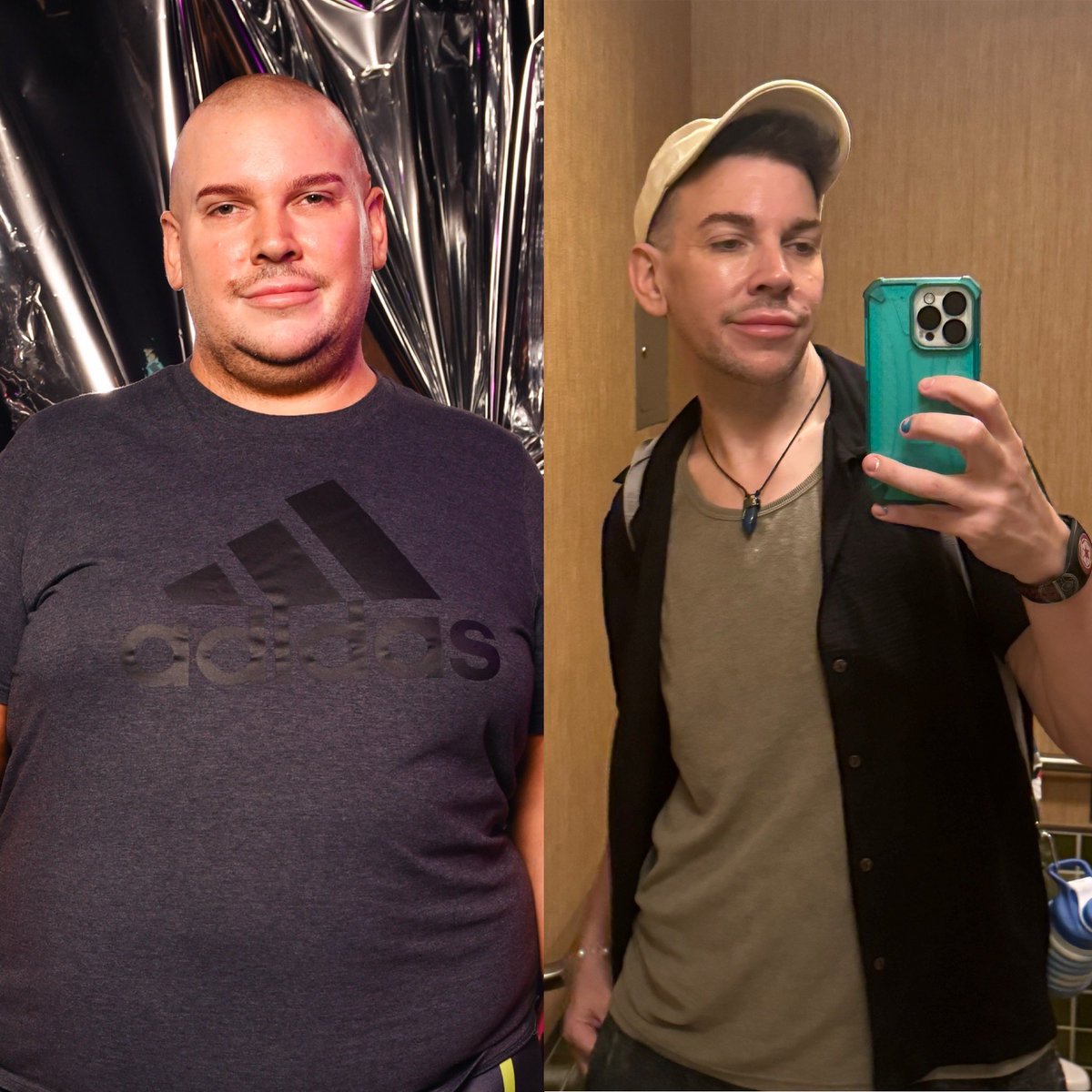 fenabarbitall's tweet image. I got gastric sleeve a year ago and I won’t shut up about it. I have lived many lives but this one I’m on now is so cunty