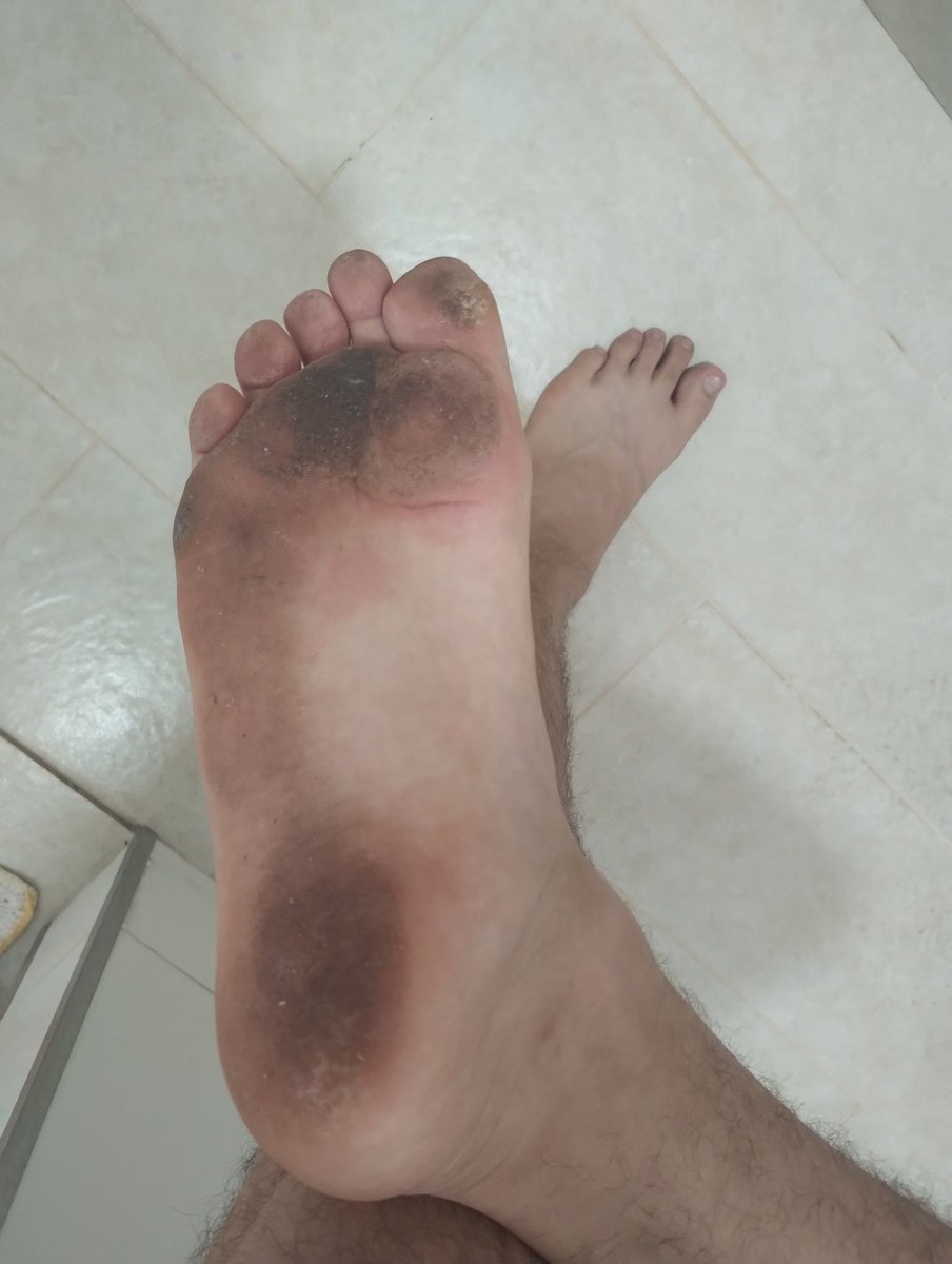ғɪɴᴅᴏᴍ ᴠɪɴ 🏆 (@findomvin) on Twitter photo Sola sujona pras Porquinhas lamberem tudo , seja útil capacho e faça o que eu mando 😈🤑🤑 #findom #cashmaster #feet #dirty #foot #Alpha @RT4MastersBR <a href="/FindomWorldRT/">THE FINDOM WORLD 🔞 |1,9K|</a> Sola sujona pras Porquinhas lamberem tudo , seja útil capacho e faça o que eu mando 😈🤑🤑 #findom #cashmaster #feet #dirty #foot #Alpha @RT4MastersBR <a href="/FindomWorldRT/">THE FINDOM WORLD 🔞 |1,9K|</a>