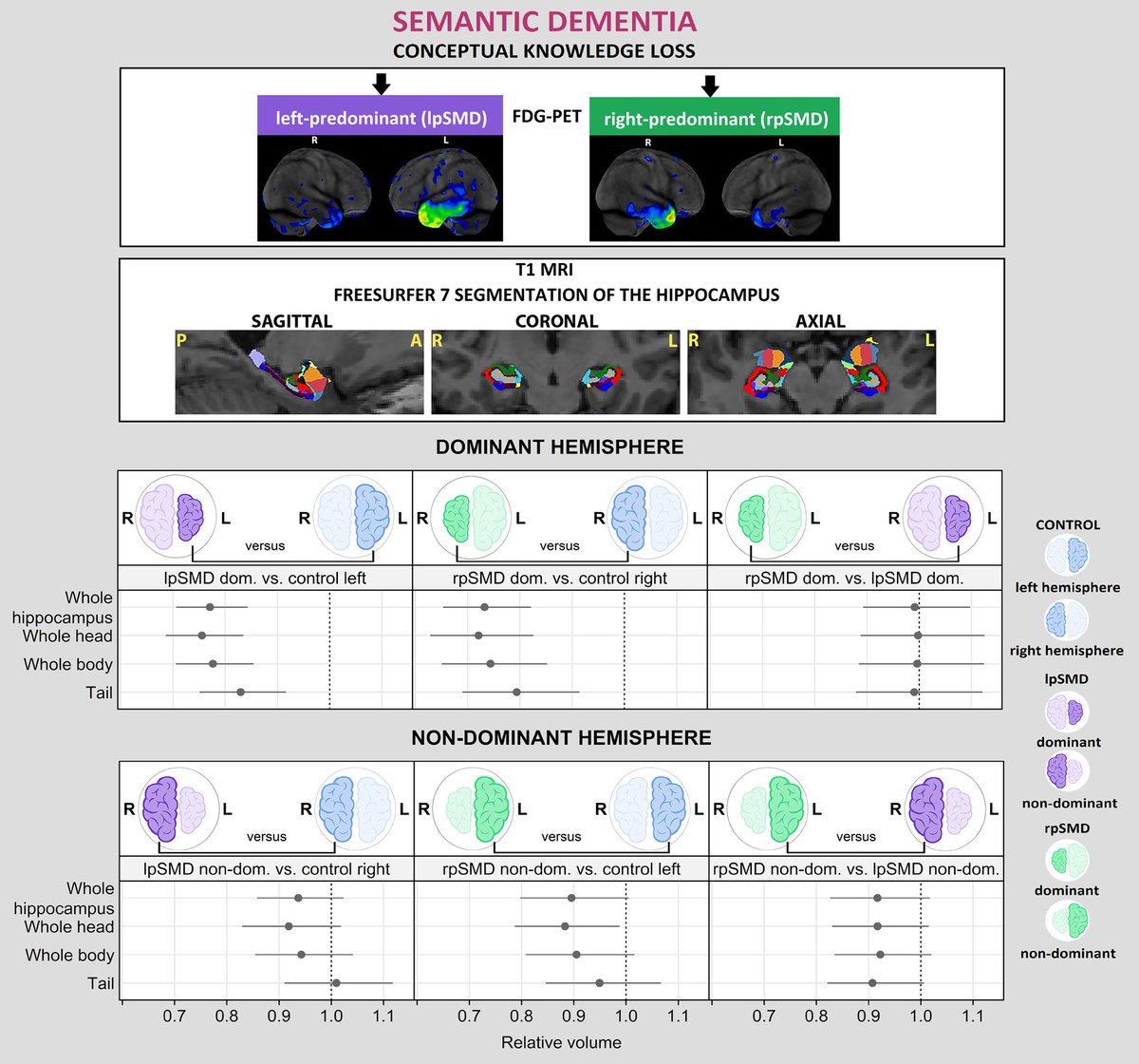 @BrainComms (@braincomms) on Twitter photo Carlos et al. studied the changes in hippocampal subregion & subfield volumes in semantic #dementia and its left and right variants where all hippocampal subregions showed volume loss in semantic dementia. <a href="/NRGMayo/">Neurodegenerative Research Group at Mayo Clinic</a> <a href="/ArennCarlos/">Arenn Carlos, MD</a>
edin.ac/3VM5jFp Carlos et al. studied the changes in hippocampal subregion & subfield volumes in semantic #dementia and its left and right variants where all hippocampal subregions showed volume loss in semantic dementia. <a href="/NRGMayo/">Neurodegenerative Research Group at Mayo Clinic</a> <a href="/ArennCarlos/">Arenn Carlos, MD</a>
edin.ac/3VM5jFp