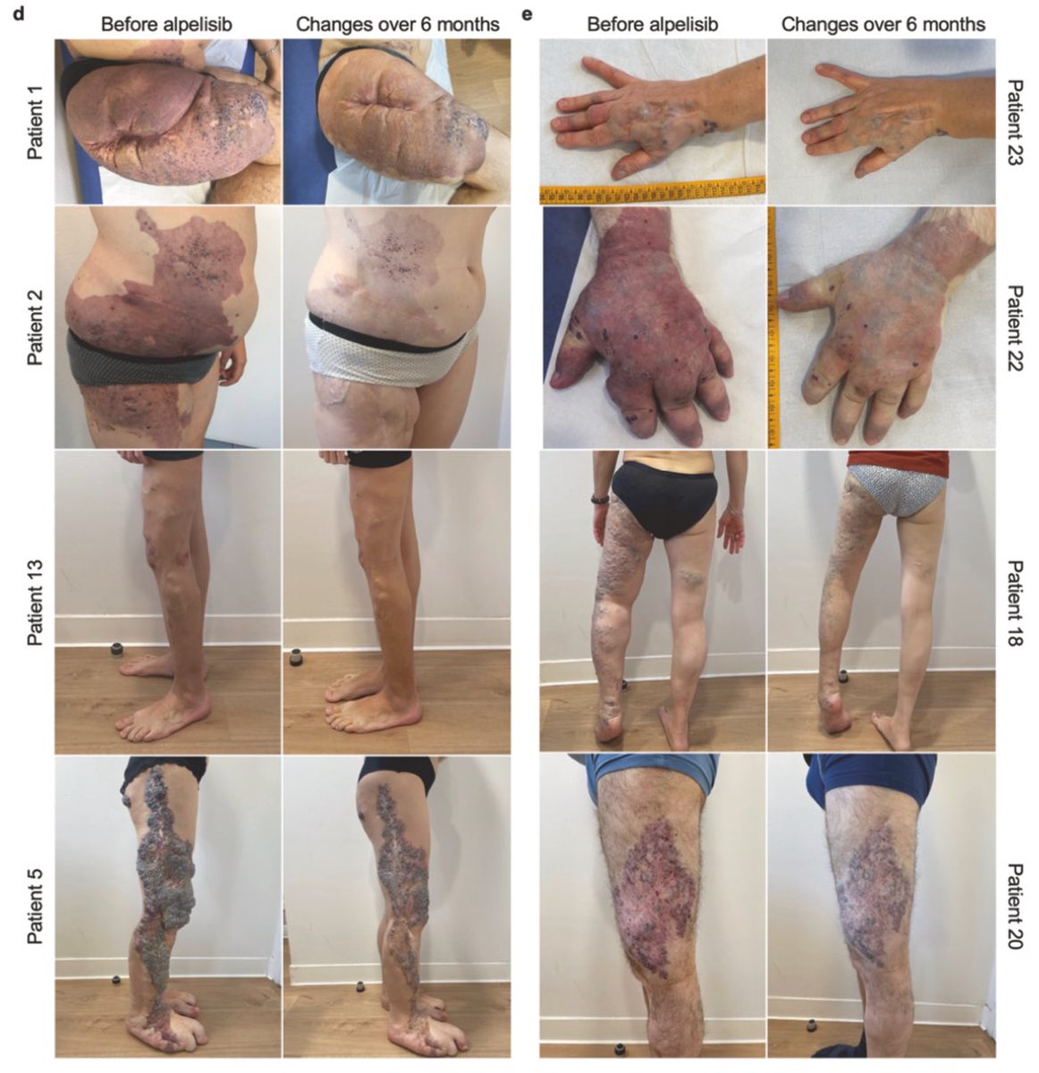 Guillaume Canaud (MD, PhD) tweet media