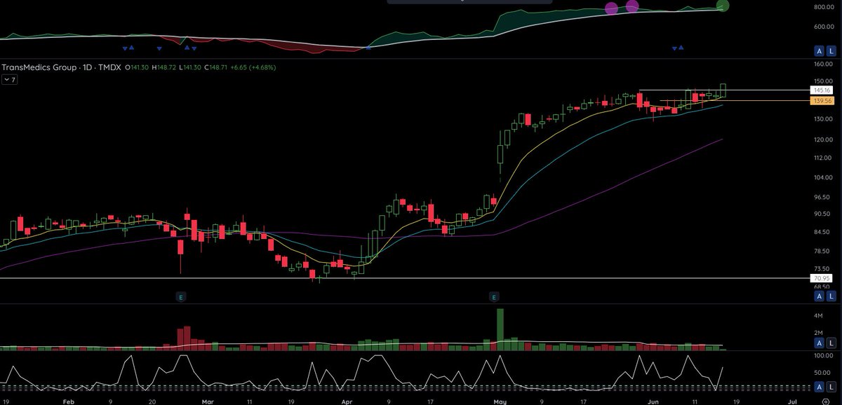 ryannader3's tweet photo. $TMDX going https://t.co/7ZvaaDxCnq