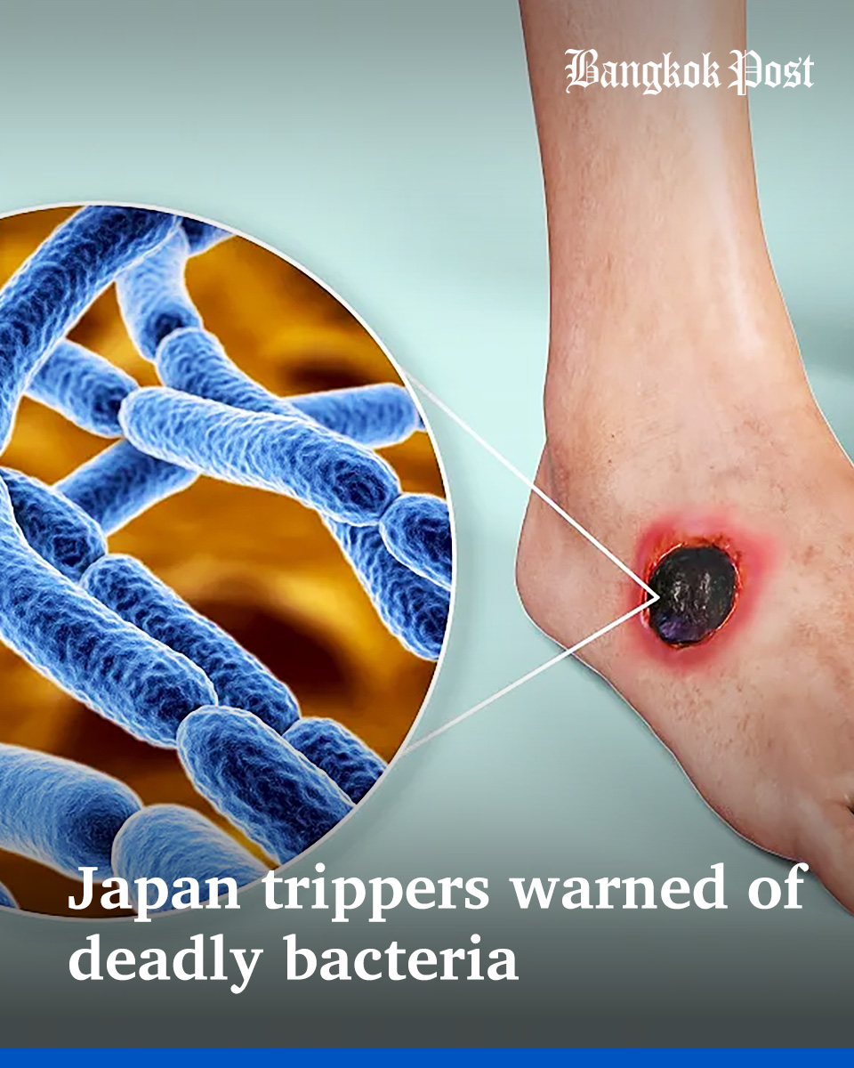 BangkokPostNews's tweet photo. #BangkokPost: The Department of Disease Control (DDC) is warning Japan-bound travellers to seriously protect themselves against infection by a rare and often fatal flesh-eating bacteria now spreading there. #Thailand #Health #Japan #travel #bacteria #flesheating
https://t.co/a8CIPP2auD