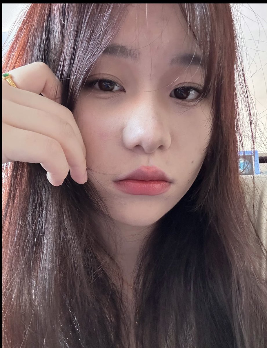ding1547749's tweet photo. 还是不能多吃 https://t.co/OB1QLtbOjs