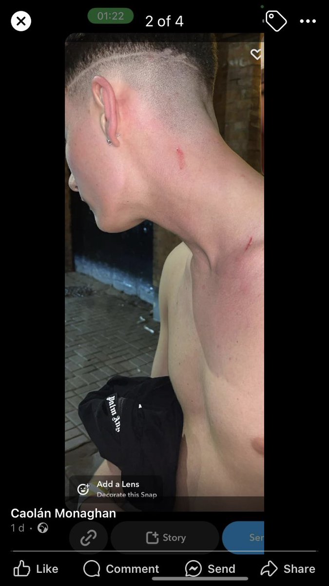 doc_kevdoc7's tweet image. Anyone know her, beat my kid inside/outside limelight on Saturday night abt 1am, he done well to keep himself composed &amp;amp; calm never lifted his hand to her, all cos she stole his mates e-fag &amp;amp; he asked for it back