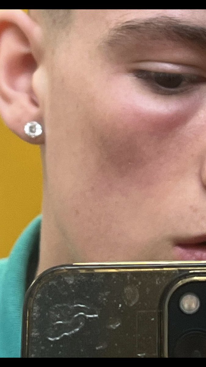 doc_kevdoc7's tweet image. Anyone know her, beat my kid inside/outside limelight on Saturday night abt 1am, he done well to keep himself composed &amp;amp; calm never lifted his hand to her, all cos she stole his mates e-fag &amp;amp; he asked for it back