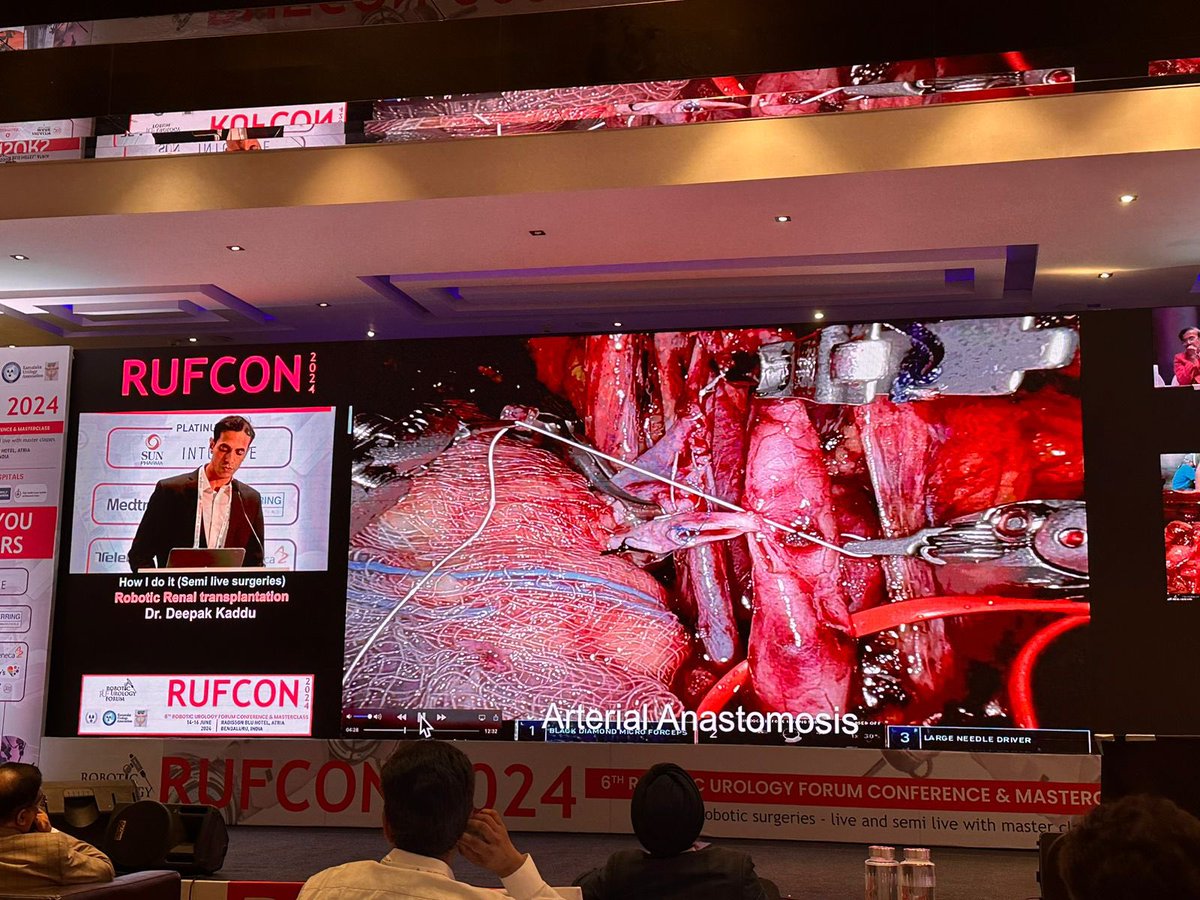 DrDeepakJK's tweet photo. RUFCON 2024, Bengaluru!👍👌
National level Annual Robotic Conference!🙏💐🎉 Academic fest  with fun!☺️

Presented as Faculty😊:
Robotic Assisted Kidney Transplant,
How I do it at Manipal Hospital, Bengaluru!

Part of live surgery Robotic Kidney Transplant from Manipal Hospital!👌 https://t.co/4bwjCsRJPF