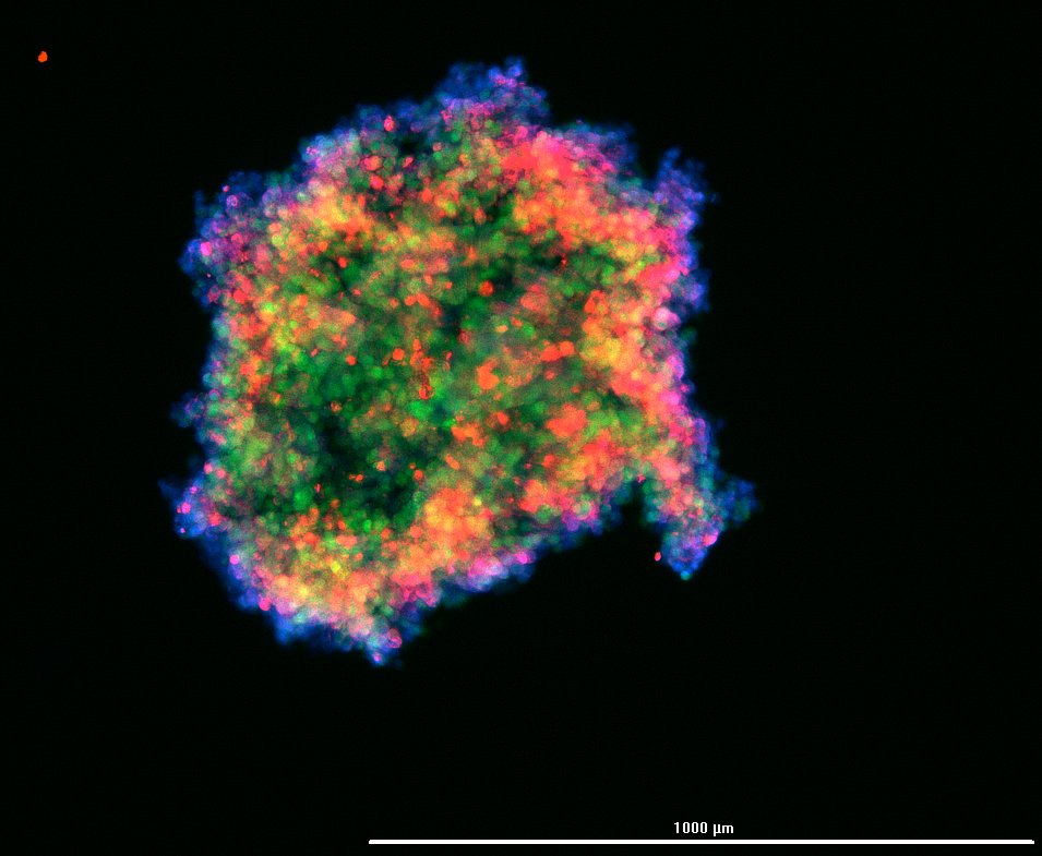 Cristina Andreani (@crandreanis) on Twitter photo After all, it is pride month and we like this "rainbow death" ππ cit. <a href="/SchrenkSandra/">Sandra Schrenk</a> #spheroids #celldeath #ferroptosis After all, it is pride month and we like this "rainbow death" ππ cit. <a href="/SchrenkSandra/">Sandra Schrenk</a> #spheroids #celldeath #ferroptosis