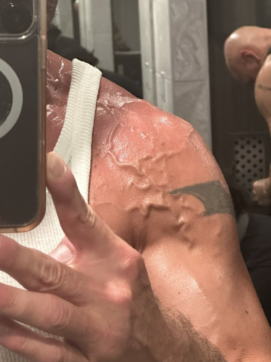 JohnnyKashmere's tweet photo. No Vein, No Gain. #Veinity
#vascular #vascularity #veins #VeinsInMyVeins https://t.co/ZCcv1zWTMA