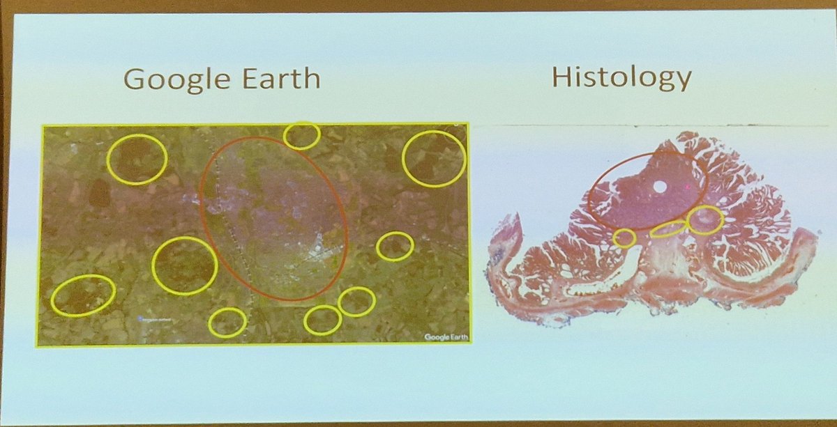 Alastair Lamb (@lambalastair) on Twitter photo Really enjoyed this cool fusion of image pattern recog concepts in #SpatialBiology vs #GoogleEarth from <a href="/leedham_simon/">Simon Leedham</a> at <a href="/UniPadova/">Università di Padova</a> #SummerSchool2024 #TranslSciClinCare
Trees=cells
Rivers=stroma etc
Amazing transfer of knowledge from ecology to histology
#MathematicalBiology Really enjoyed this cool fusion of image pattern recog concepts in #SpatialBiology vs #GoogleEarth from <a href="/leedham_simon/">Simon Leedham</a> at <a href="/UniPadova/">Università di Padova</a> #SummerSchool2024 #TranslSciClinCare
Trees=cells
Rivers=stroma etc
Amazing transfer of knowledge from ecology to histology
#MathematicalBiology