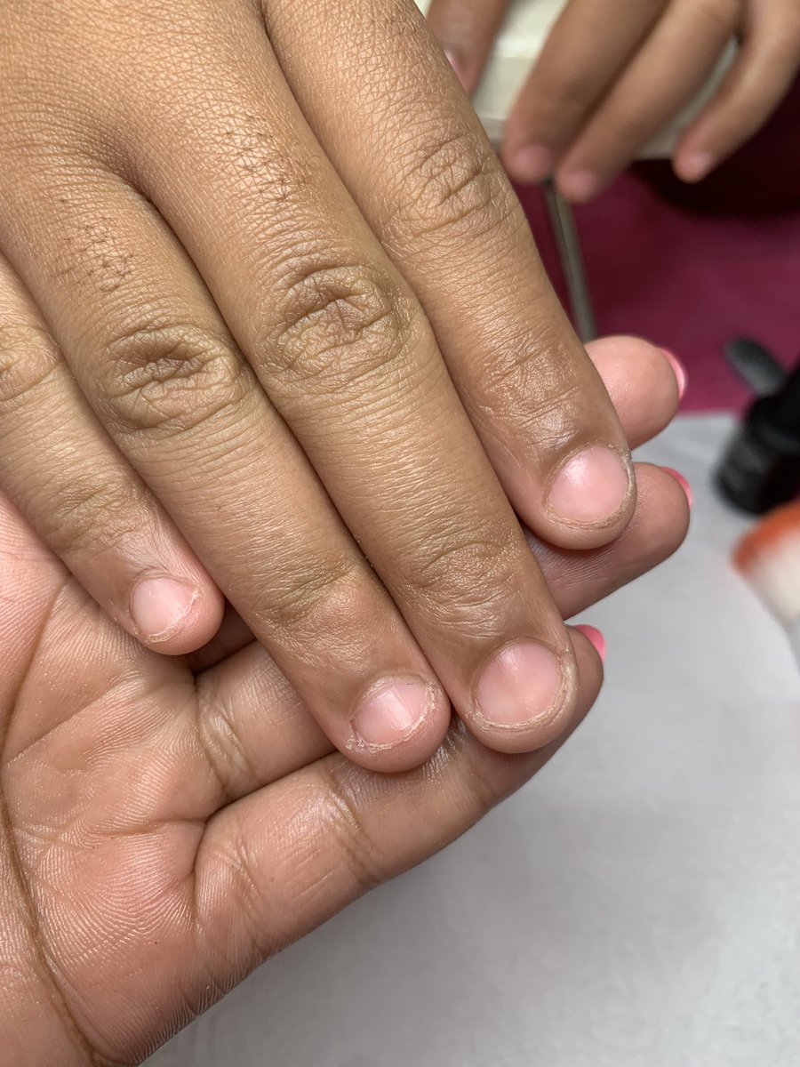 Sthxndo_H's tweet photo. How she left vs how she came in💅🏼🥵 
📲WhatsApp 76752926 📍Tsholofelo East, Gaborone 

Kindly repost, my next canvas might be on your TL🖌️ https://t.co/Iw7g4mOjIt